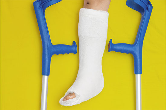 Ein Fuß und Bein in Gips vor einfarbigem Hintergrund, links und rechts davon je eine Krücke. 